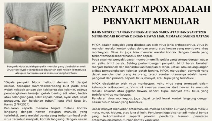 Waspada Risiko Penyebaran Penyakit Mpox